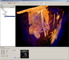 new volume with adv. transfer function