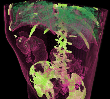 MRT scan of lower torso